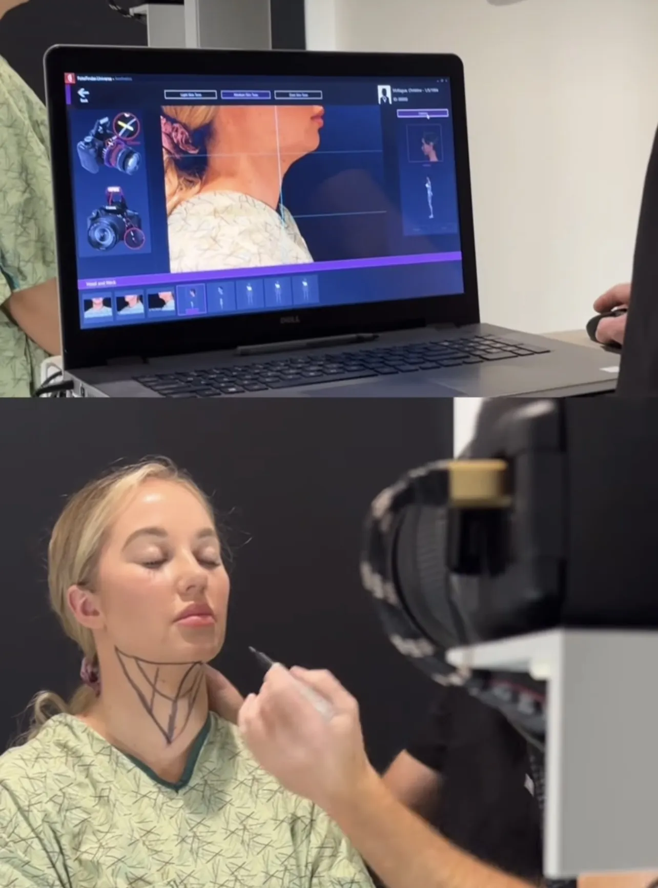 Dr. Tredennick Prepping patient for neck/chin lipo procedure at silk touch in boise, Idaho