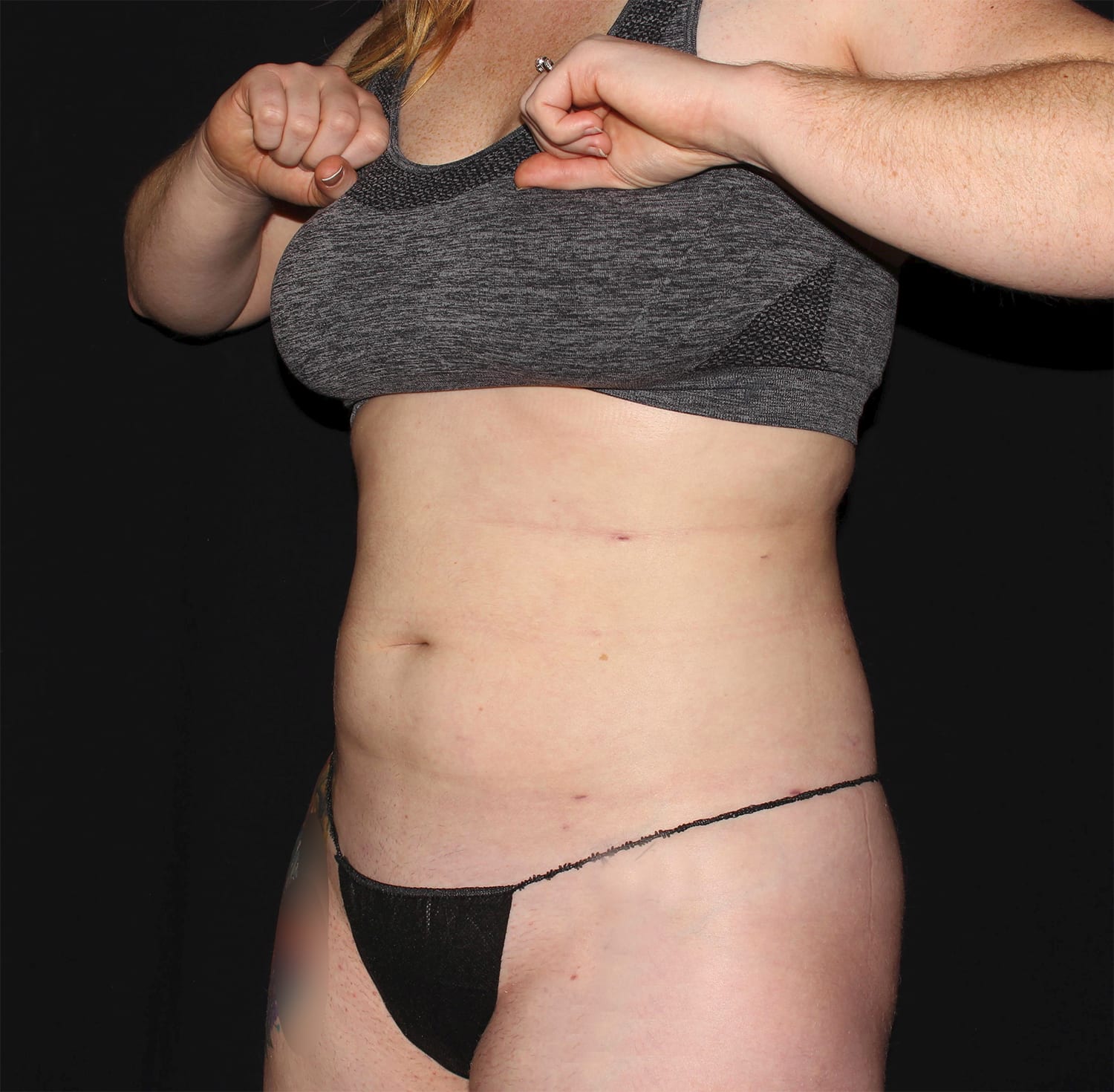 After Image: Abdomen & Waist - left-front-oblique