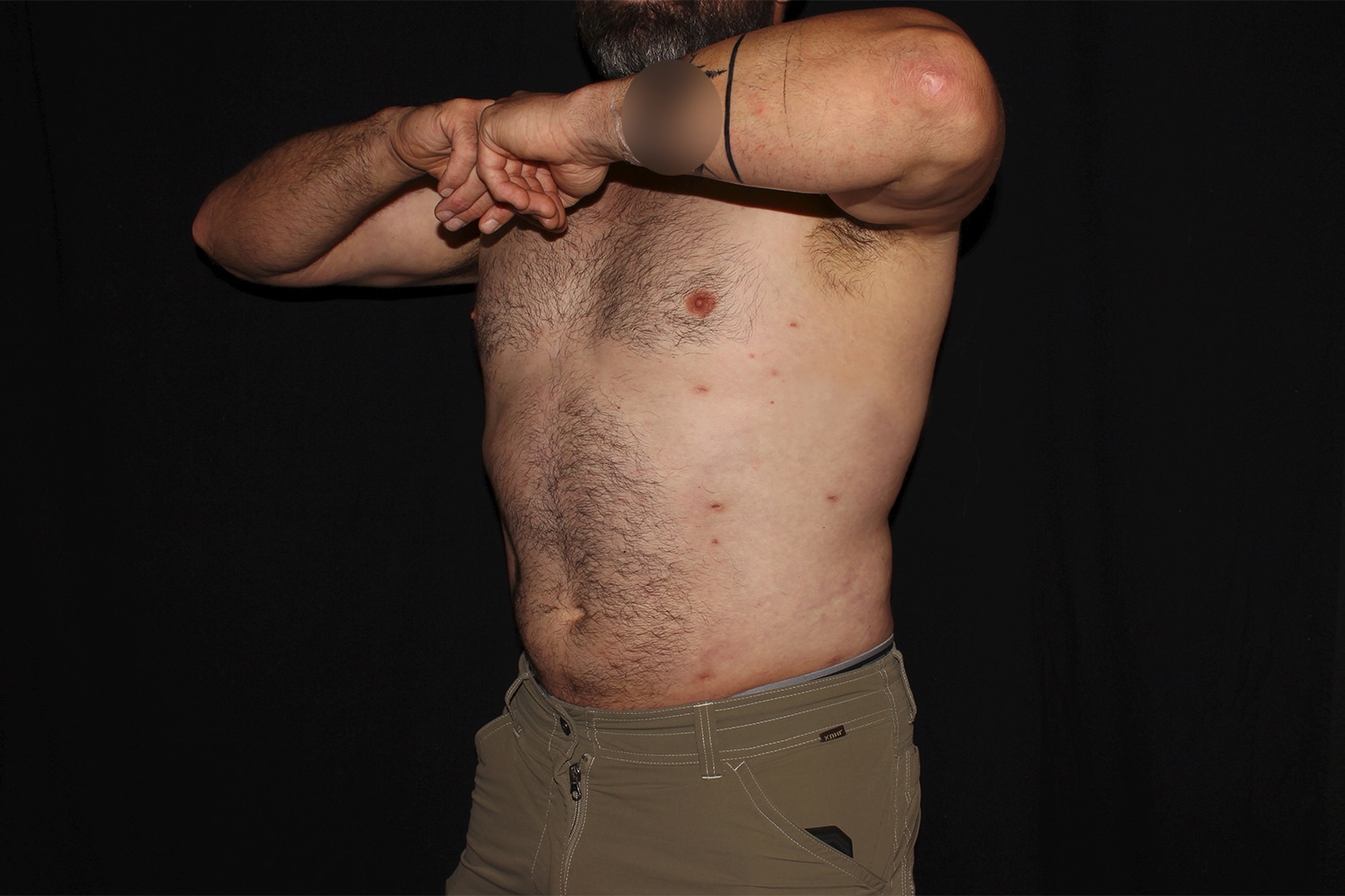 After Image: Chest & Abdomen - left-front-oblique